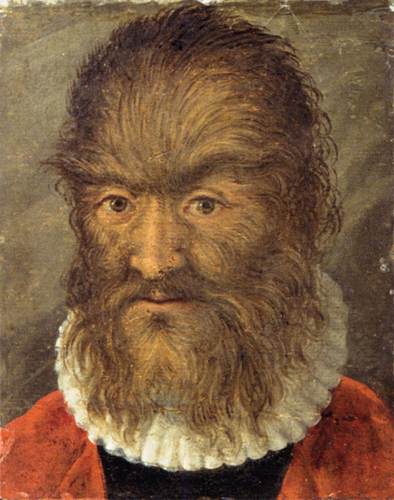 Hairy Man from Munich, 1580, 