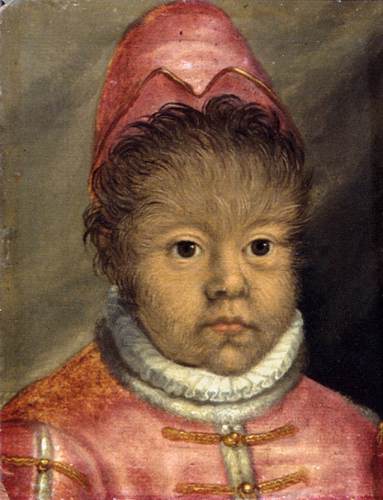 The Son of the "Hairy Man from Munich", 1580, 