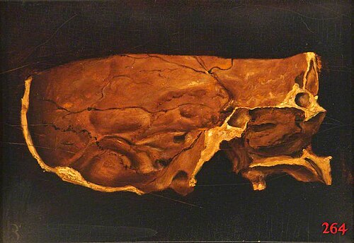 Skull, Section, , Jacobus Schijnvoet