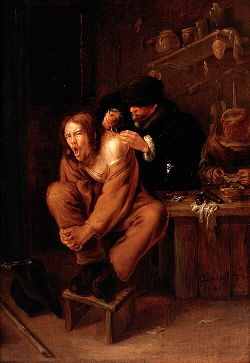 A surgeon applying medicine to a wound in the shoulder of a man in pain., , Gerrit Lundens