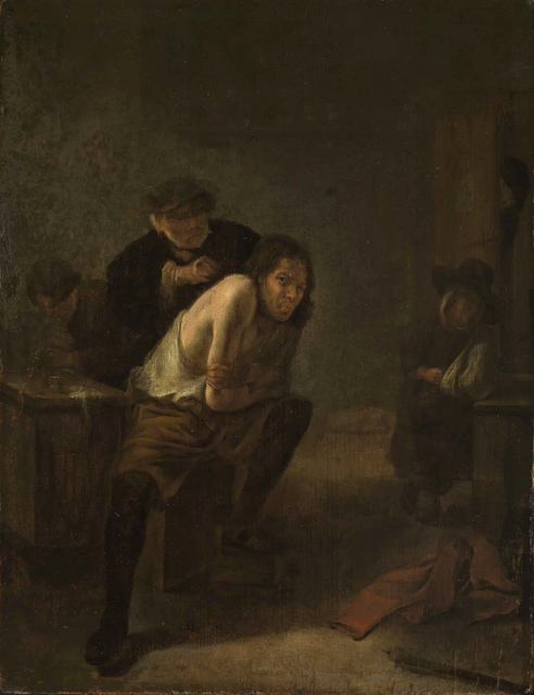An Operation on the Shoulder, 1650, Gerrit Lundens