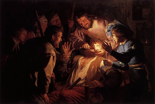 The Dentist, 1622, Gerrit van Honthorst
