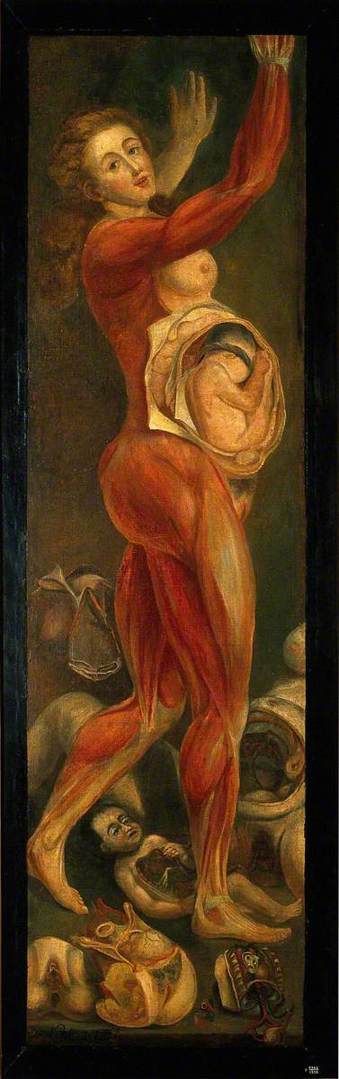 A Pregnant Woman, Dissected, Lateral View, with Arms Upraised, Accompanied by Separate Sections of t, 1764, Jacques Fabien Gautier d'Agoty