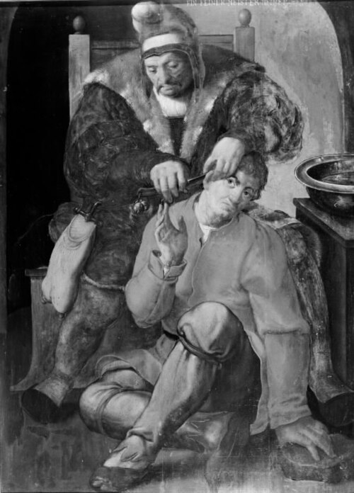 A Surgeon Operating on a Peasant, 1521, Lucas van Leyden