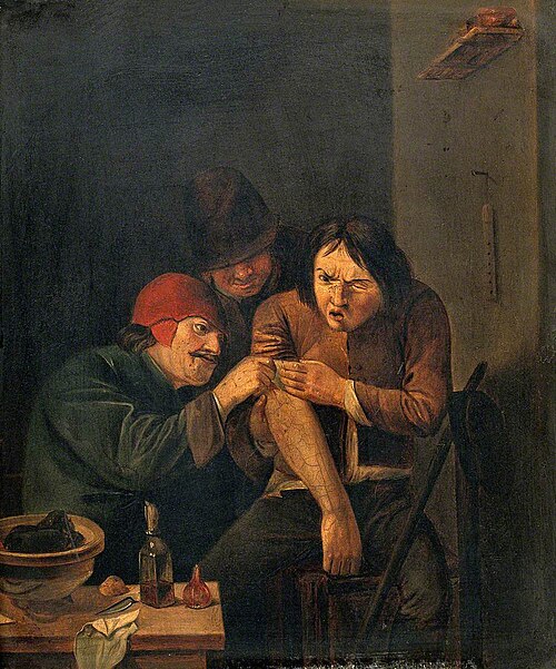 A Surgeon Attending to a Man's Arm, , Adriaen Brouwer