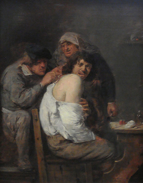 The Back Operation, 1630, Adriaen Brouwer