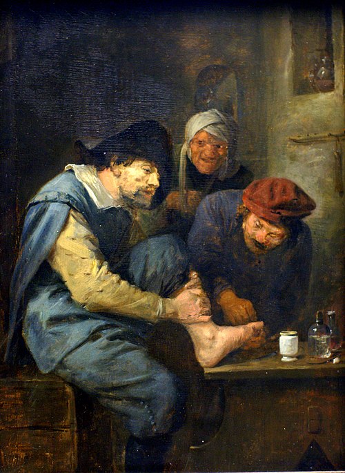L'opération au pied, 1636, Adriaen Brouwer