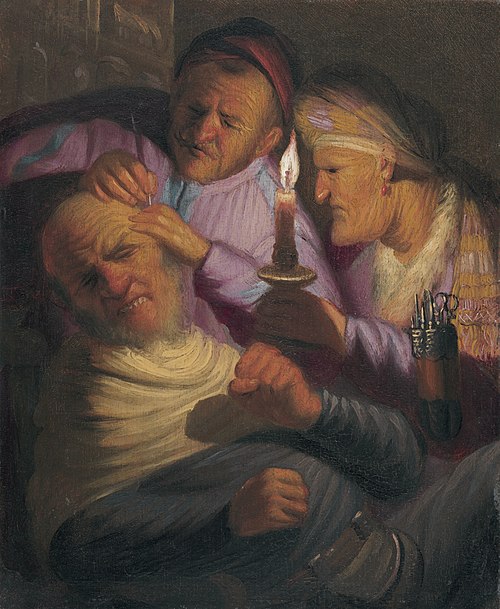 The Operation (Allegory of Touch), 1624, Rembrandt