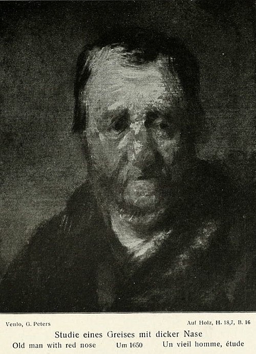Study of a man with a swollen nose, 1650, Rembrandt