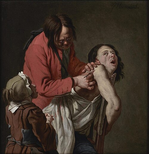 The Shoulder Operation, 1750, Jan Josef Horemans I