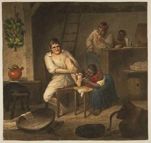 Extracting bicho-do-pé (foot worm), 1850, Augustus Earle
