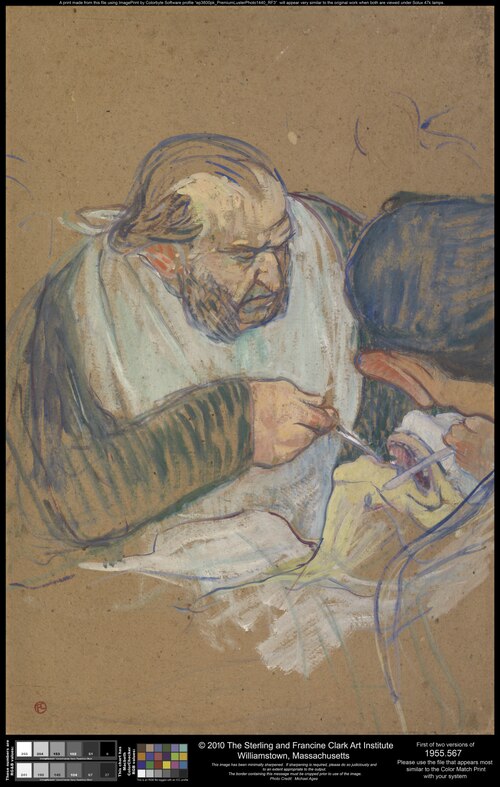 Dr. Péan Operating, 1891, Henri de Toulouse-Lautrec
