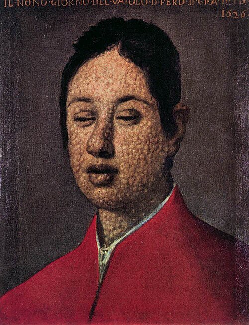 Portrait of Ferdinando II on the ninth day of smallpox, 1626, Justus Sustermans